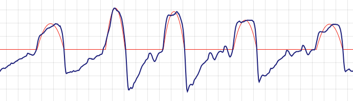 Image of variable amplitude breathing
